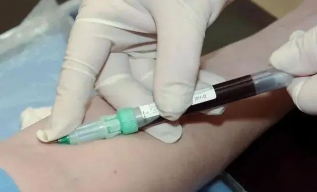 测血糖扎哪根手指最准确？提醒：多数人扎“错了”，测了等于白测