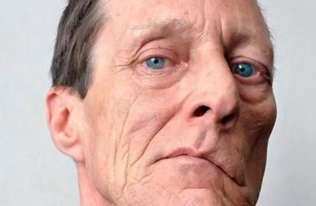寿命“藏”在脸上？长寿的人脸上或会有这5个特征，占一个也不错