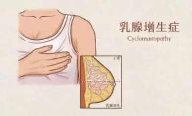 体检查出7种病，听着可怕，却基本不用治疗，医生：别花冤枉钱