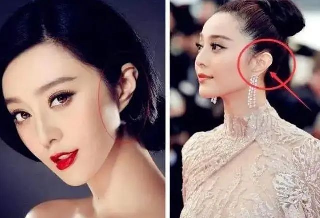 耳朵不同命不同？“穷人耳”“富人耳”有啥区别？你耳朵什么样