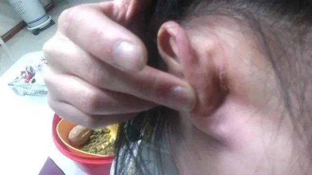 耳朵不同命不同？“穷人耳”“富人耳”有啥区别？你耳朵什么样