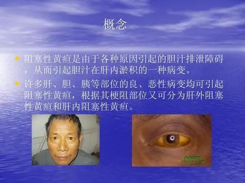 半夜总是2个时间惊醒？或是肝在“求救”，多喝2茶，帮你养好肝