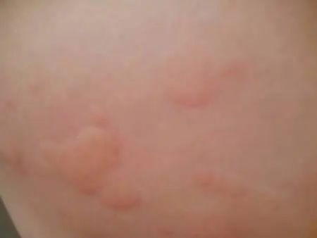 中药变“毒药”，几个小时可发作？医生：这5种中药没病别乱吃